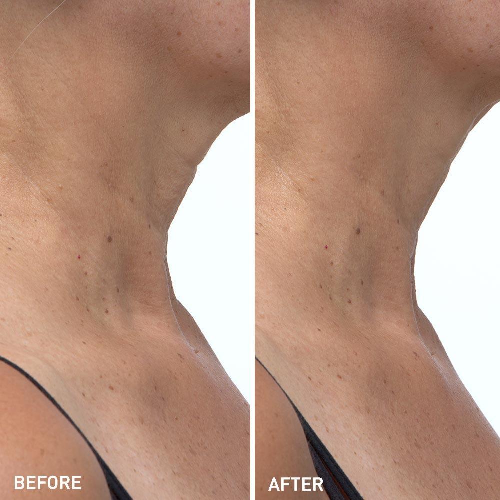 Photo of Hydro Cool Firming Neck Gels